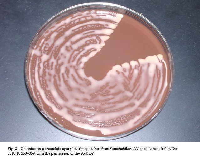 Peritoneal Dialysis infection Organism