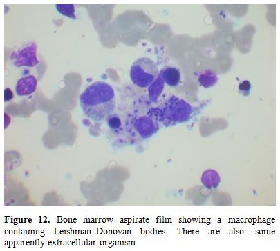 Figure12