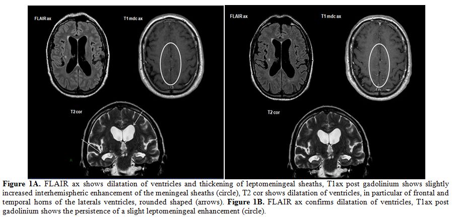 Figure 1A-1B
